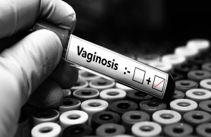 UCT Scientists Pioneer “Live Medicine” to Combat Bacterial Vaginosis UCT research. Lactobacillus crispatus. VIBRANT study. women's reproductive health. microbiome science. Bacterial Vaginosis treatment. vaginal microbiome. live biotherapeutic products.