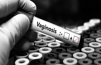 UCT Scientists Pioneer “Live Medicine” to Combat Bacterial Vaginosis UCT research. Lactobacillus crispatus. VIBRANT study. women's reproductive health. microbiome science. Bacterial Vaginosis treatment. vaginal microbiome. live biotherapeutic products.